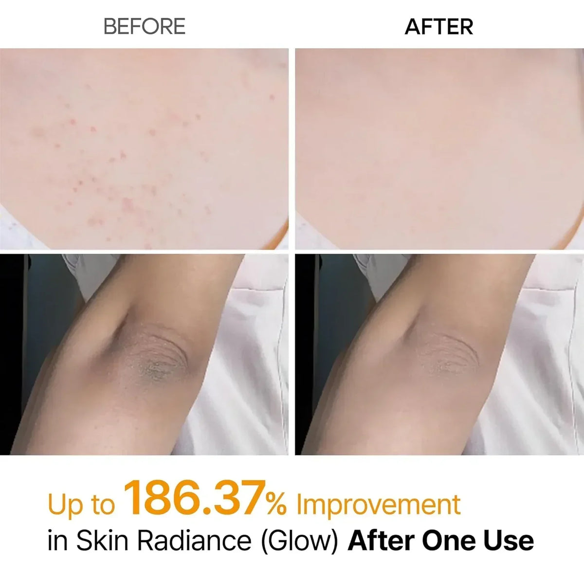 Dr.Melaxin Peel Shot Exfoliating Kojic Acid Turmeric Spray
